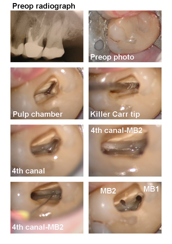 KW endo pg 1.jpg